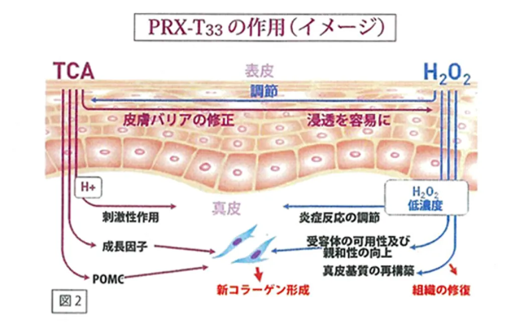 PRX-T33イメージ